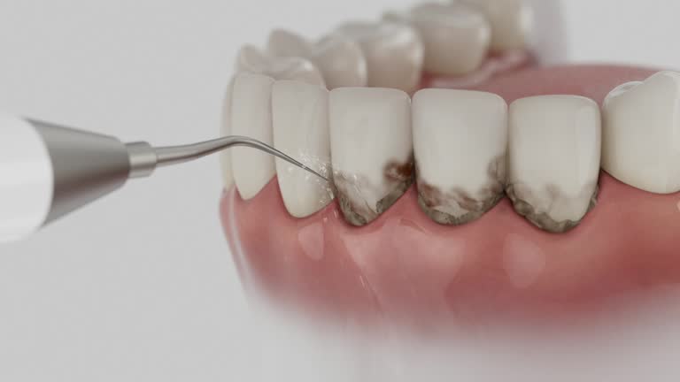 Reliable Dental Implants contractor in Sheridan, IN by Smile Center Dentistry